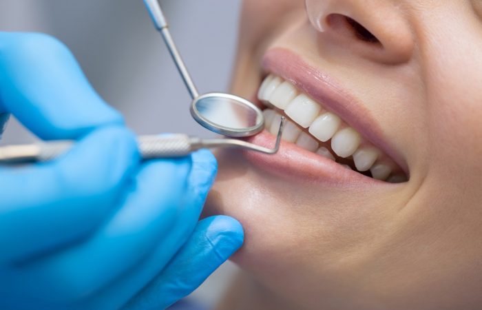 Odontología general - BF Estetica Dental - Centro odontológico - Ortodoncia