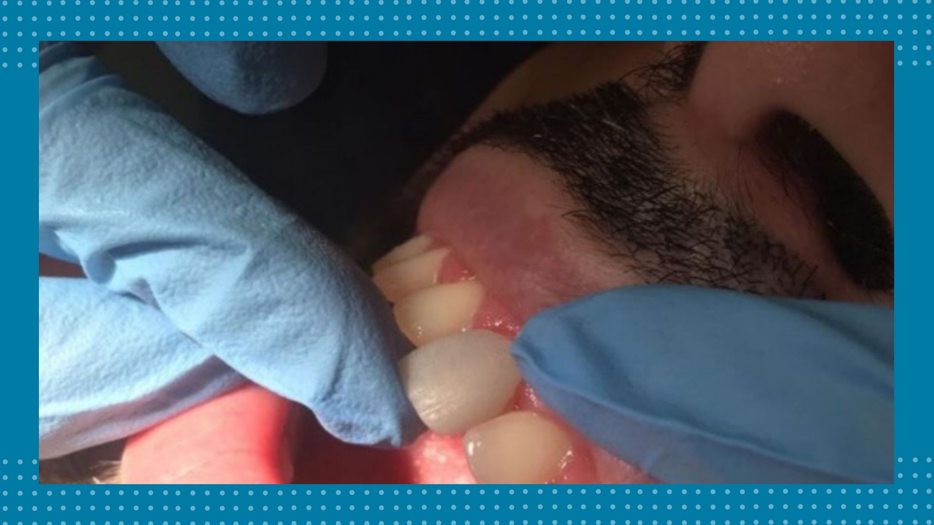 Centro odontológico BF Estetica Dental - Carillas - Caracas - Venezuela