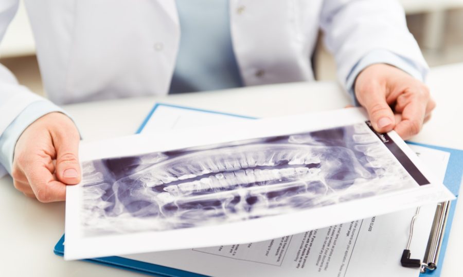 Radiologia dental- BF Estetica Dental - Centro odontológico - Ortodoncia