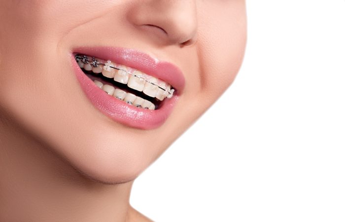Ortodoncia Centro odontológico - Ortodoncia