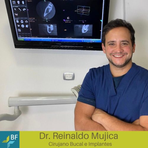 BF Estetica Dental - Cirujano Bucal - Implantes - Reinaldo Mujica
