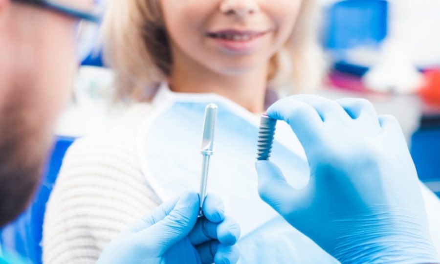 Implantes - Caracas - Venezuela - BF Estética Dental