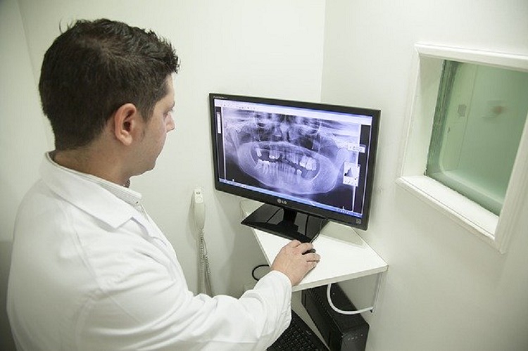 Tomografía dental - Radiología - BFEstéticaDental - Destacada