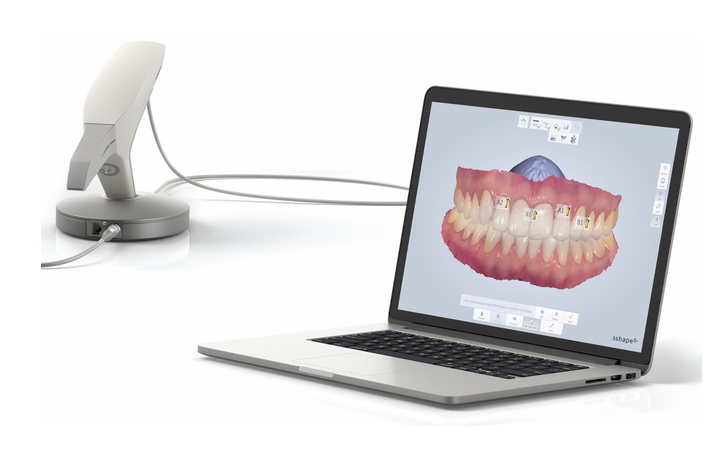 Impresiones 3D - Nuevas tecnologías - BFEstéticaDental