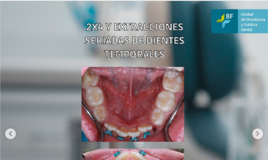 Técnica de 2 por 4