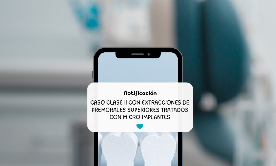 Microimplantes Clase II Bfesteticadental Imagen principal