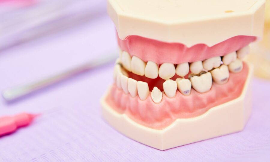 BFesteticadental clase III