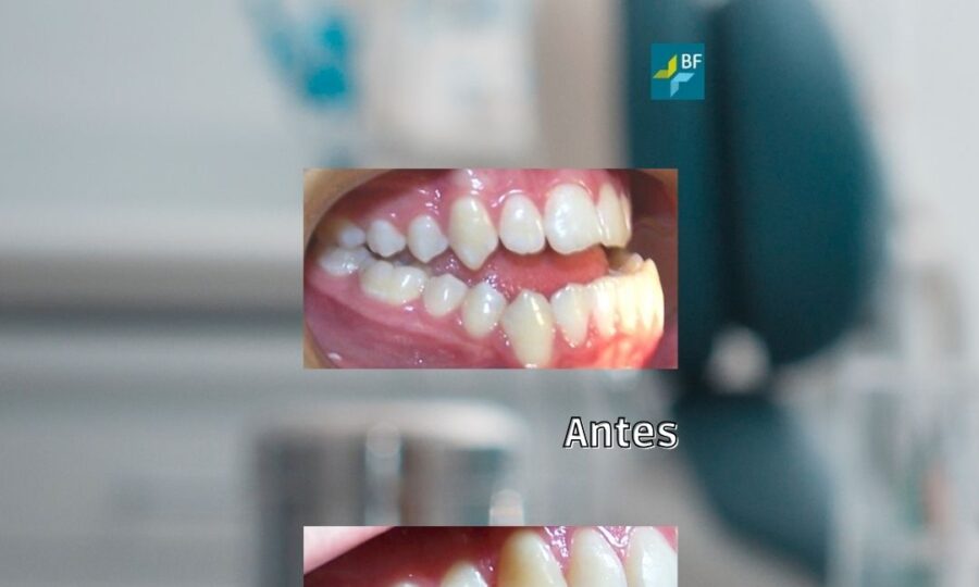Procedimientos Quirúrgicos 3