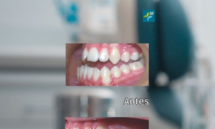 Procedimientos Quirúrgicos 4