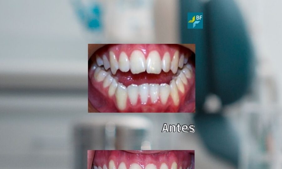 Procedimiento Quirúrgicos 5