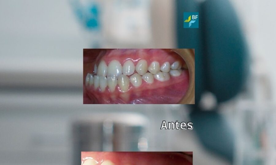 Procedimientos Quirúrgicos 7
