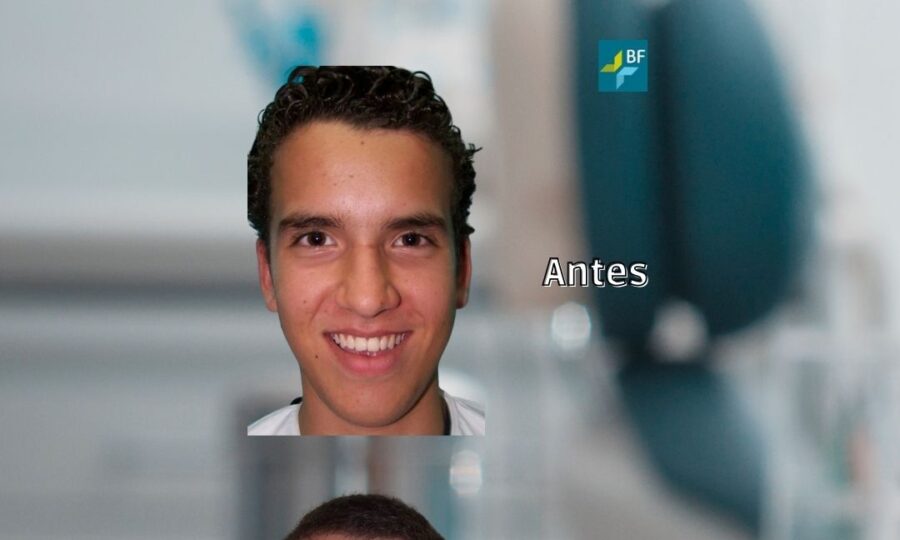 Procedimientos Quirúrgicos 9