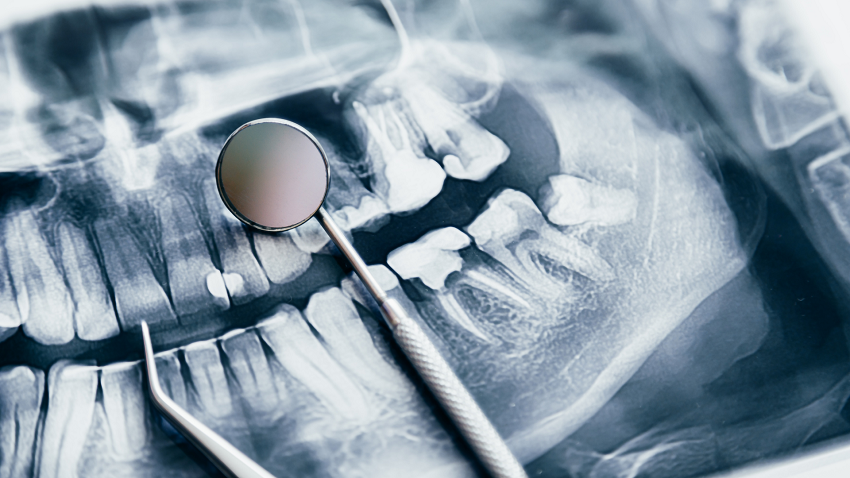 Radiología bucodental 1 - Avances tecnológicos - BFEstéticaDental