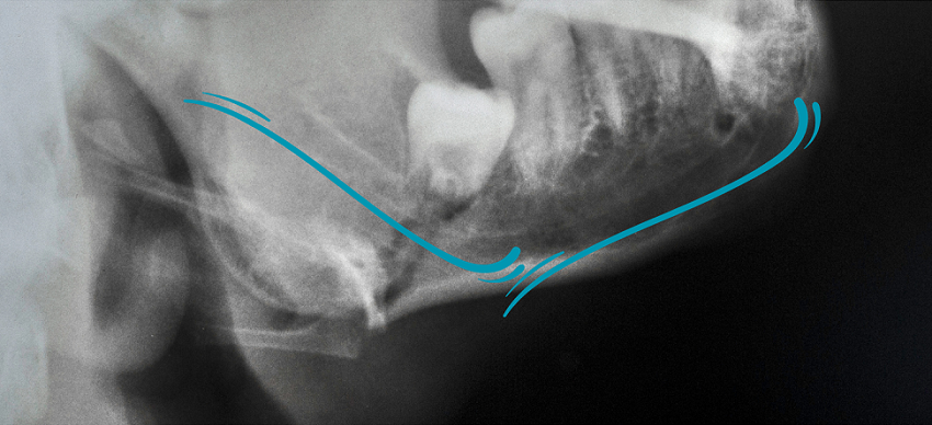 Conducto Alveolar Inferior (CAI) estructura anatómica - BFEstéticaDental