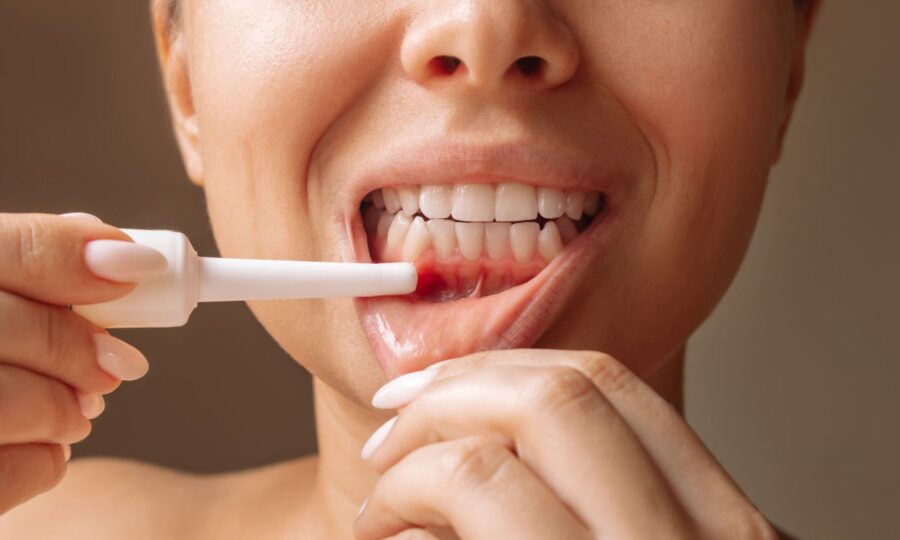 Periodoncia Avanzada - Salud de las encías - 1 BF Estética Dental